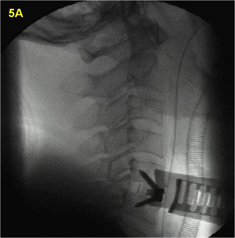 ACDF_fig5a.jpg