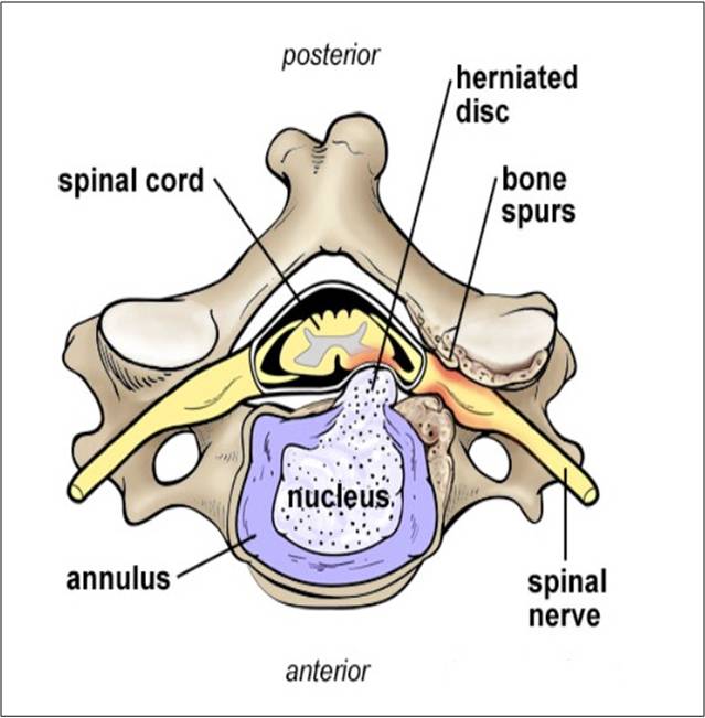 ACDF_fig1.jpg